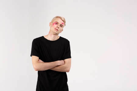 A guy with a battered face. There are several bruises and scratches on the face with blood.の写真素材