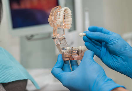 Jaw with prosthesis in dentist's hands in gloves