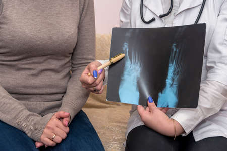 Doctor pointing on patient's x-ray close up