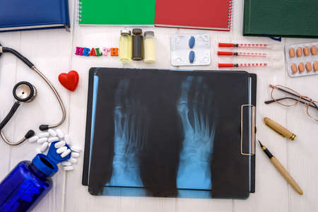 X-ray with pills and notepads on table
