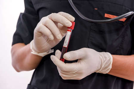 Chemistry and laboratory experiment concept. Man in medical uniform and protective gloves holding red test tubeの写真素材