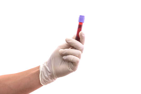 Human hands with red test tube isolated on white. Medical conceptの写真素材