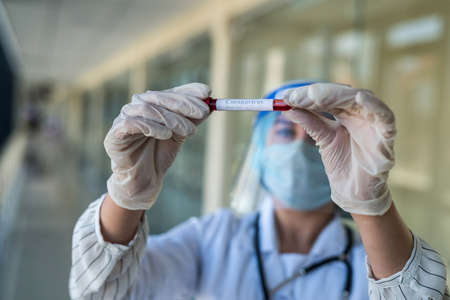 Young female doctor wearing face shield holding test tube with a blood sample with a positive result...