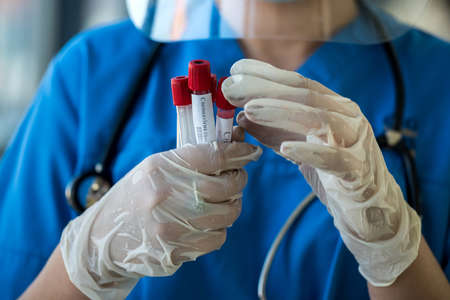 medical worker holding test tube with blood sample to detect a new virus Coronavirus covid 19 in...