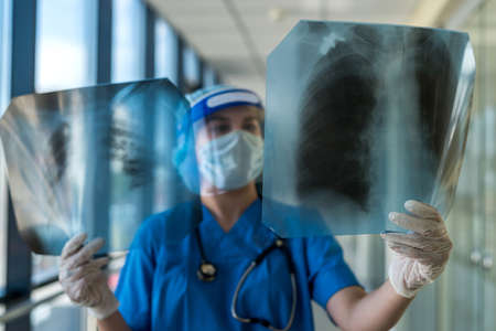 student intern in a protective suit and face shield looks at a xray film of the lungs, covid19....
