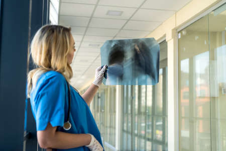 Young blonde female doctor wearing blue uniform with stethoscope holding chest xray film and checking on pneumonia. covid19の写真素材