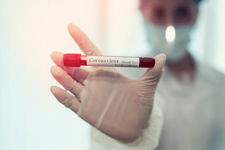 Medical worker holding test tube containing a blood sample that has the result positive for...