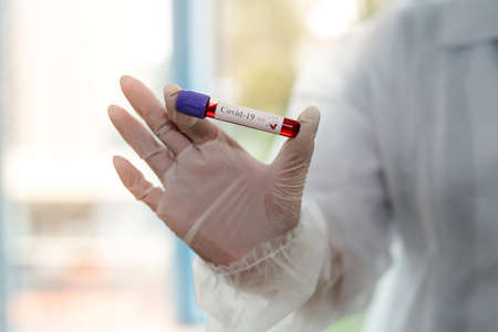 female hand hold test tube with blood sample for laboratory testing on analyzing new infection...