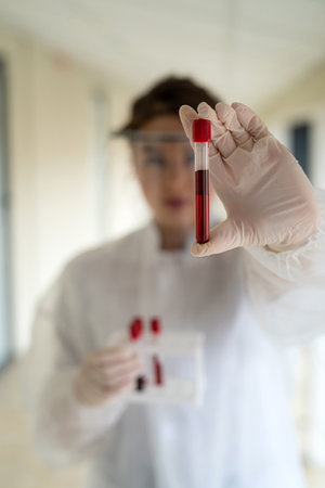 young pretty nurse looking at a blood sample for diagnostic on Coronavirus or COVID-19