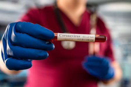 Male doctor or biochemist wear red uniform, gloves from virus disease examines blood in a test tube in modern hospitalの写真素材