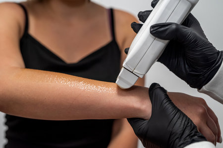 master applies wax using a cartridge to the client's hand. depilation of hands. waxing. sugaring...