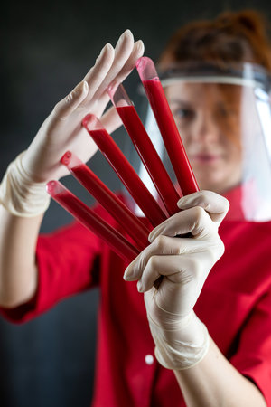 woman lab assistant in red uniform hold blood sample in tube isolated on black, research in clinical laboratoryの写真素材