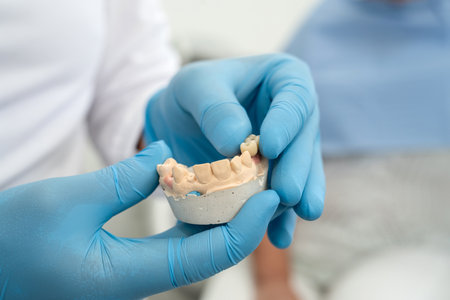 Dentist holding model of dental implant. Artificial teeth with steel pin