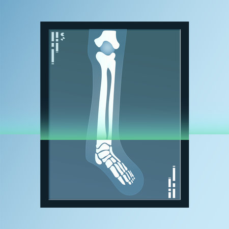 X-ray image of human foot. Vector illustration.のイラスト素材