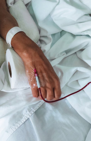 Close-up of a hand receiving blood transfusionの写真素材