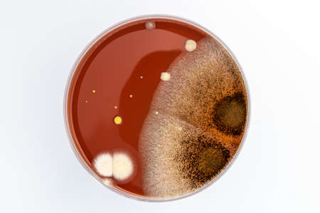 Petri dish with mixed of bacteria coloniesの写真素材
