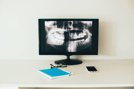 X-ray on the monitor screen at the dentist. The workplace of the dentist. X-ray of the human jaw. Radiologist describes a picture of the patient's jaw. Notebook, pen, smartphone and eyeglasses lie on the light desktop. Medicine.の写真素材