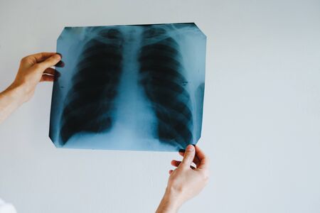 The doctor or nurse holds an X-ray of the lungs. X-rays of a man's lungs.