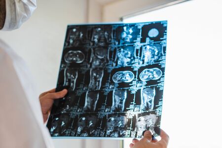 The doctor holds a picture of the human organs. X-rays of human organs in the hands of the doctor. International doctors day. Doctor on the front line.の写真素材