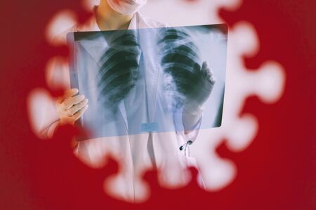 A radiologist in a medical mask and gloves radiates an x-ray image of the patients lungs. The doctor...