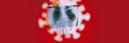 Banner. A radiologist in a medical mask and gloves radiates an x-ray image of the patients lungs. The doctor is holding an X-ray of his lungs. Coronavirus.の写真素材