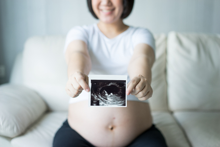 Pregnant woman with ultrasound scan pictureの写真素材