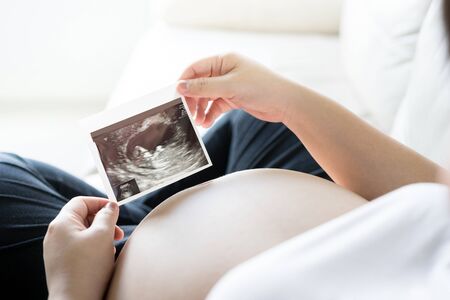 Pregnant woman with ultrasound scan picture