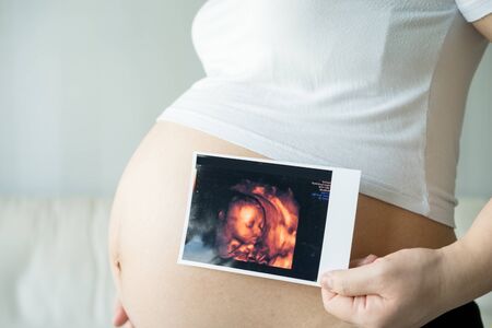 Pregnant woman with ultrasound scan pictureの写真素材