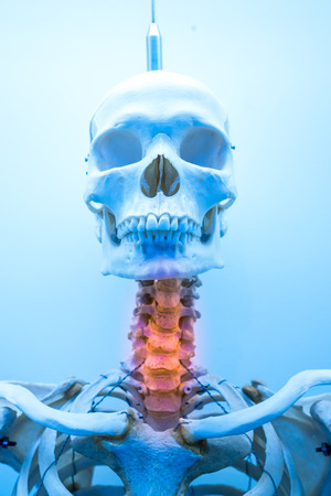 neck pain, bone inflammation