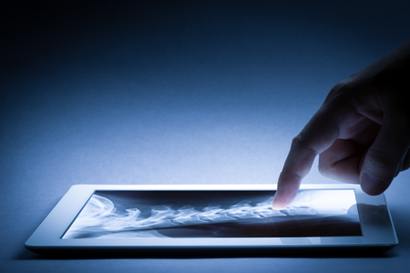 Human X-ray film exam by doctorの写真素材