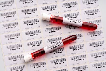 Blood test sample for COVID 19 virusの写真素材