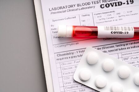 Blood test sample for COVID 19 virus