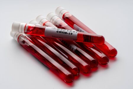 Blood test sample with DNA icon for COVID 19 virusの写真素材