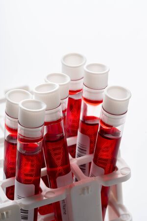 Blood test sample with DNA icon for COVID 19 virusの写真素材