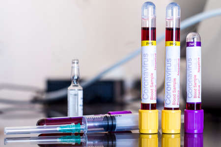 Blood tubes used in vaccine studies on the tableの写真素材