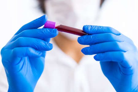 A gloved junior doctor holding blood test result for plasma in Turkey