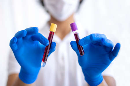 A gloved young doctor holding blood test result for plasma in Turkey