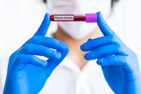 A gloved junior doctor holding a positive blood test result for coronavirus in Turkey