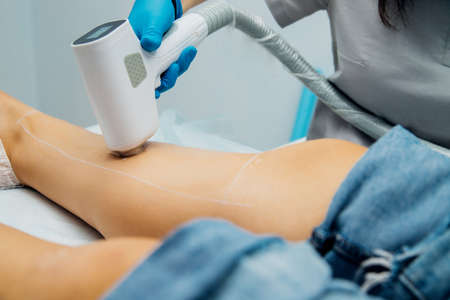 Application of contact transparent gel before the laser hair removal procedure. Application of sugar paste for the sugaring procedure. Skin care, cosmetic procedures. Women's legs. Beauty salon.の写真素材