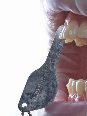 Male model mouth closely showing spacer device during orthodontic treatment with aligners