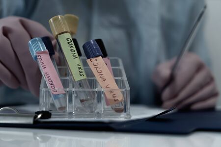 Concept of coronavirus quarantine. MERS-Cov. Novel coronavirus (2019-nCoV). Positive Coronavirus test blood sample. 2019-nCoV pandemicの写真素材