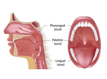 Tonsils in open mouth and sagittal viewのイラスト素材