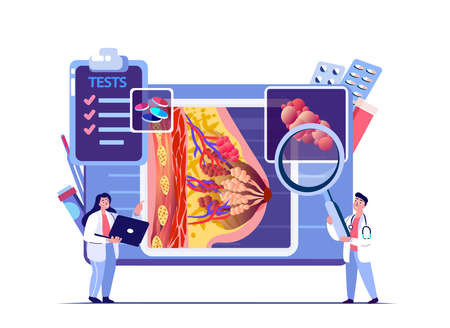 Mammologist Doctors Scientists Examine Lacteal Gland, Cancer Swelling, Female Breast. Digital Treatment.Research Trial.Clinical Investigation.Female Clinic. Medical Council Diagnostics Flat Illustrationのイラスト素材