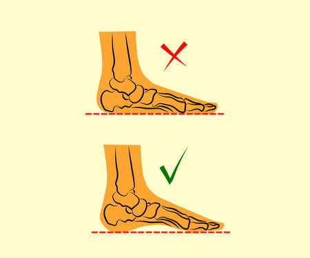 Human leg and joints. Symbol. Vector illustration.のイラスト素材