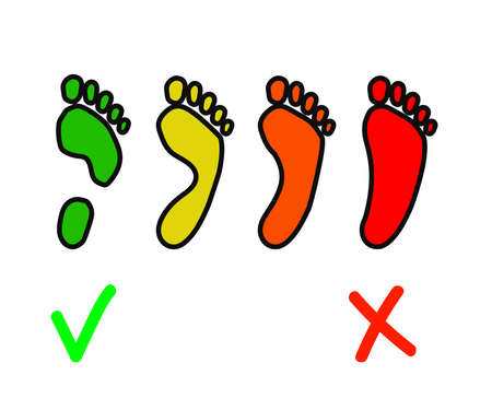 Human footprint. Flat feet. Symbol. Vector illustration.のイラスト素材