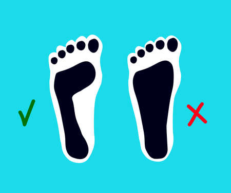 Human footprint. Flat feet. Symbol. Vector illustration.のイラスト素材