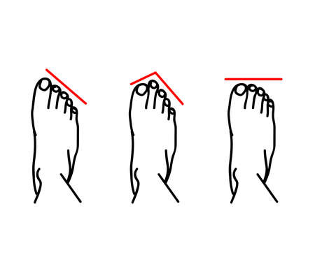 Human legs and variants of the structure of the feet. Symbol. Vector illustration.のイラスト素材