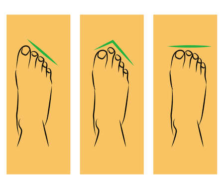 Human legs and variants of the structure of the feet. Symbol. Vector illustration.のイラスト素材