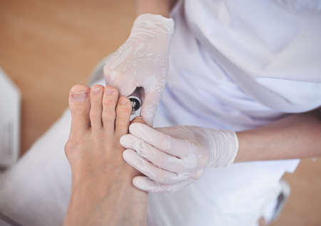 Hardware medical pedicure with nail file drill apparatus. Patient on pedicure treatment with pediatrician chiropodist. Foot peeling treatment at spa with a special device. Clinic of Podiatry Podology.の写真素材