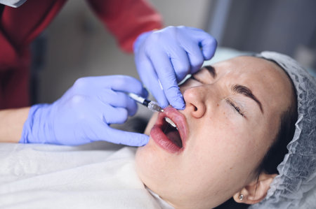 Cosmetologist doing painful lip augmentation procedure with hyaluronic acid. The beautician pierces lips by needle. Woman suffering subcutaneous injection to increase lips shape with dermal filler.の写真素材